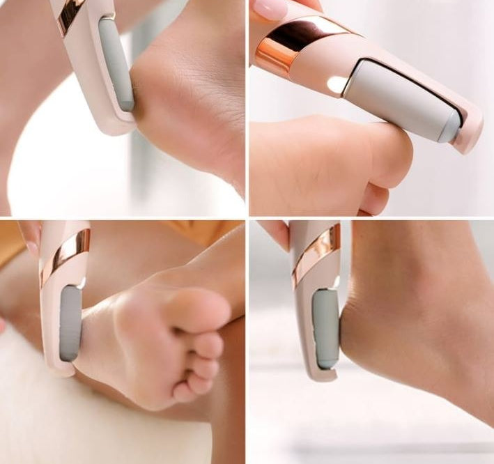 Rechargeable Pedi Foot Remover
